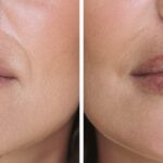 Best Ways to Convert YouTube to MP4 Using Reddit Recommendations